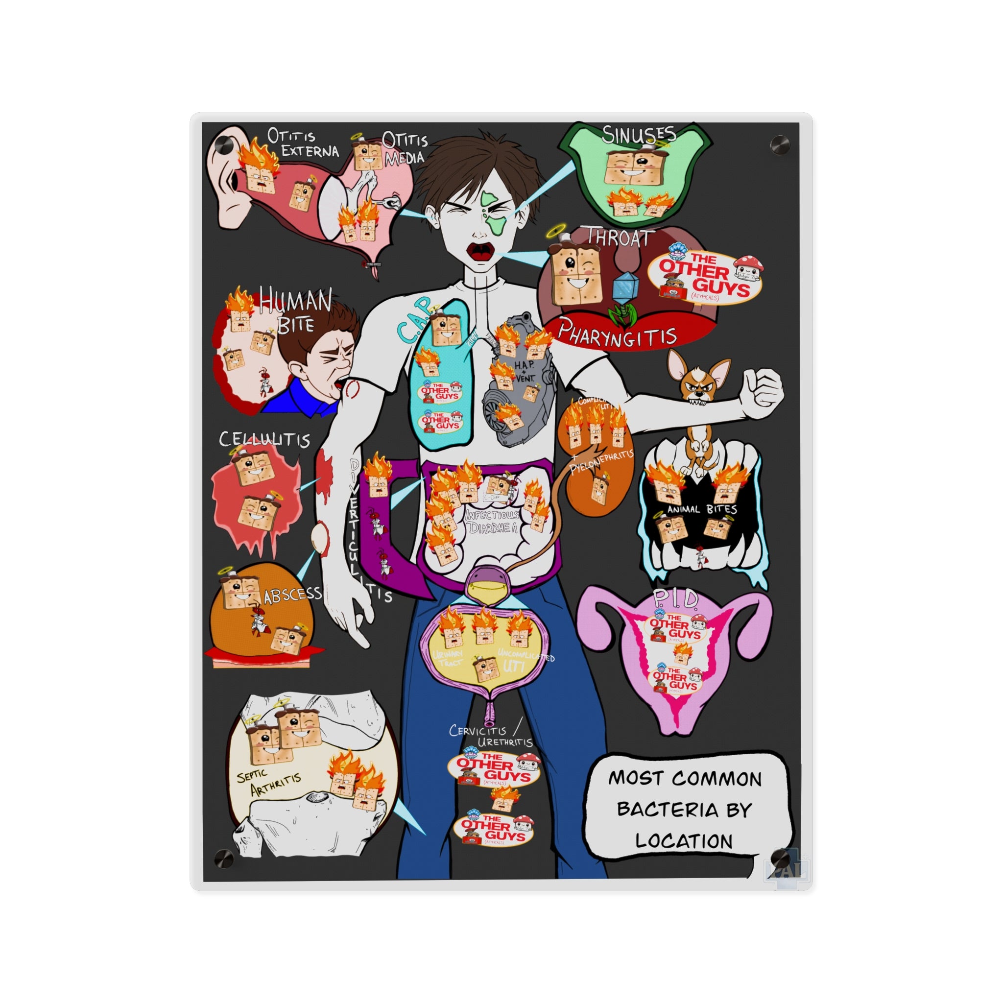 Most Common Bacteria By Location Acrylic Wall Art Panel for Patient Education in Clinics and Hospitals