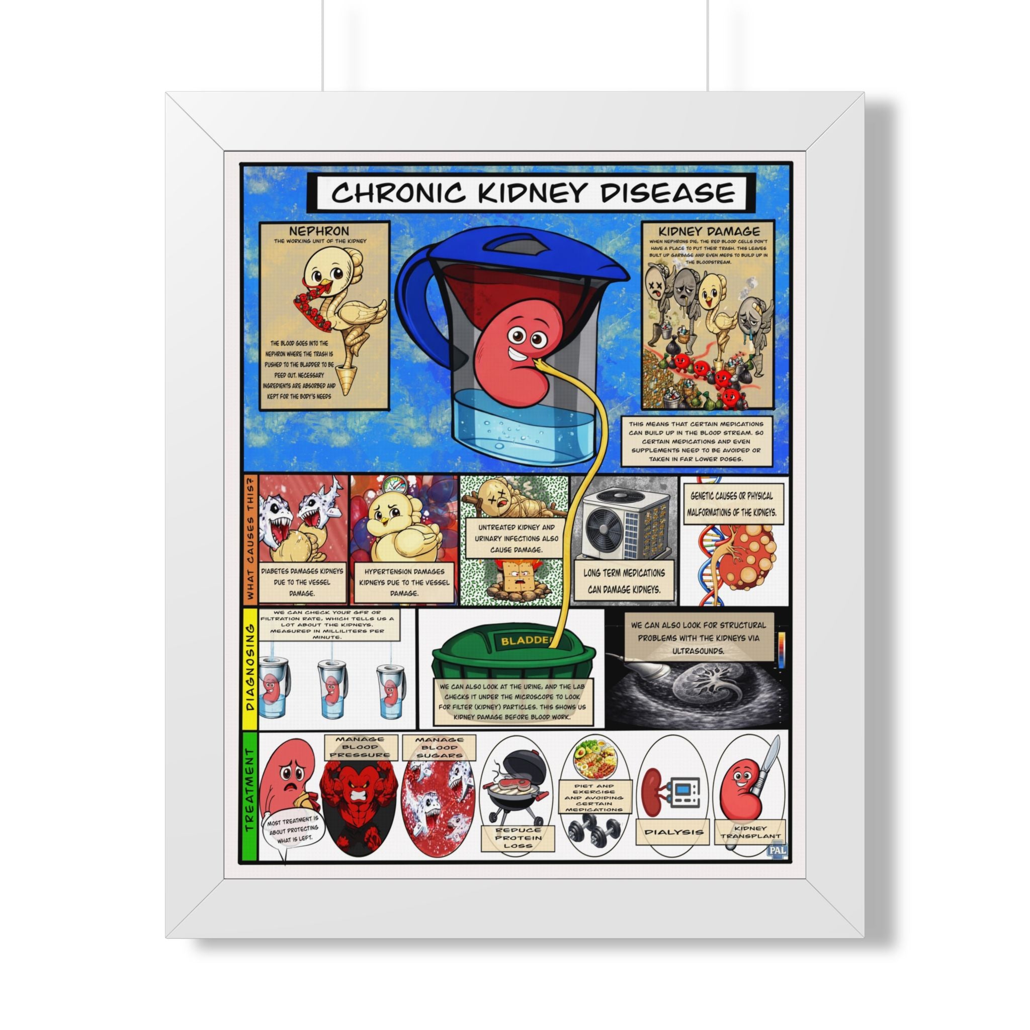 Chronic Kidney Disease Infographic for patient education in clinics, exam rooms, hospitals.