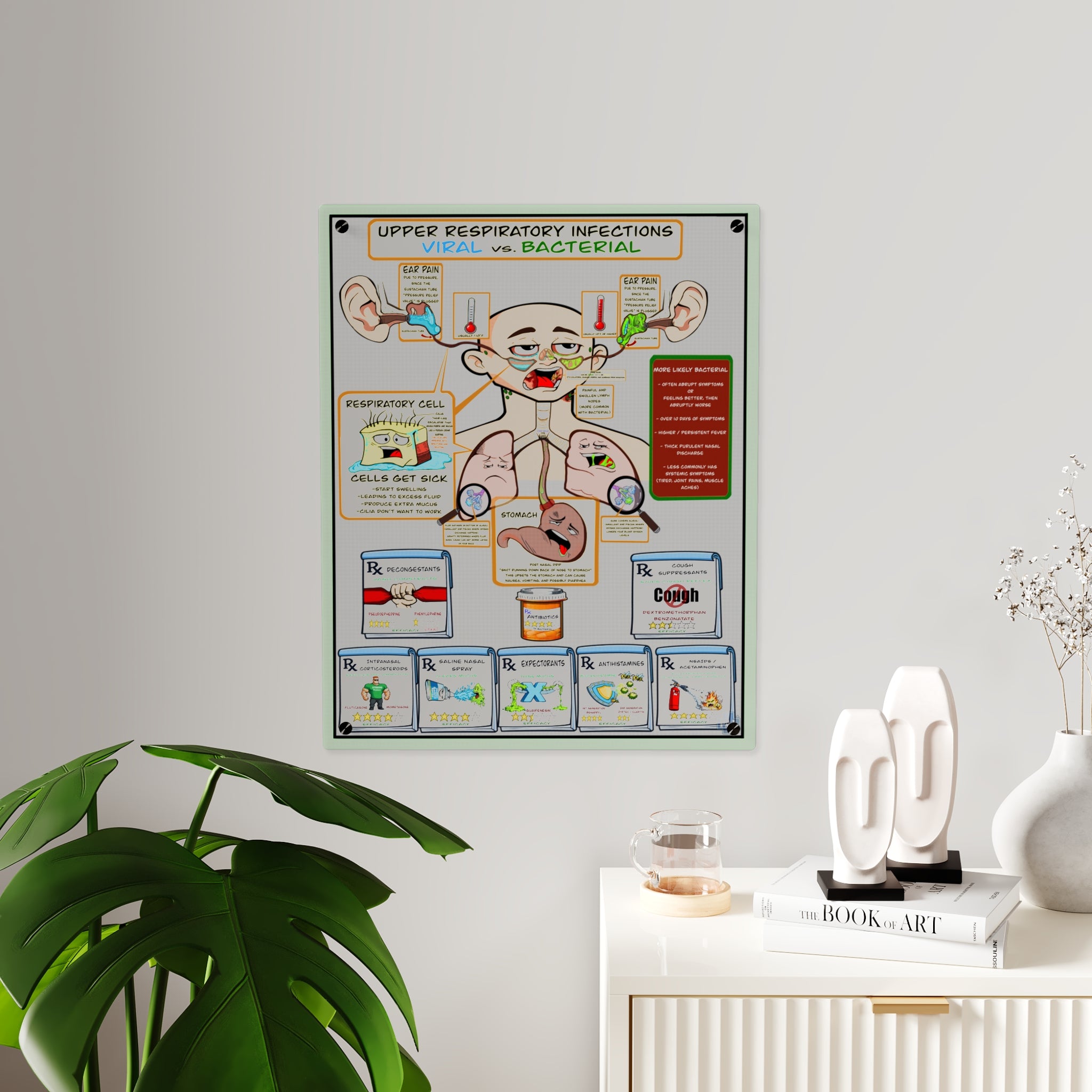 URI Acrylic Wall Art Panel for Patient Education in Clinics and Hospitals