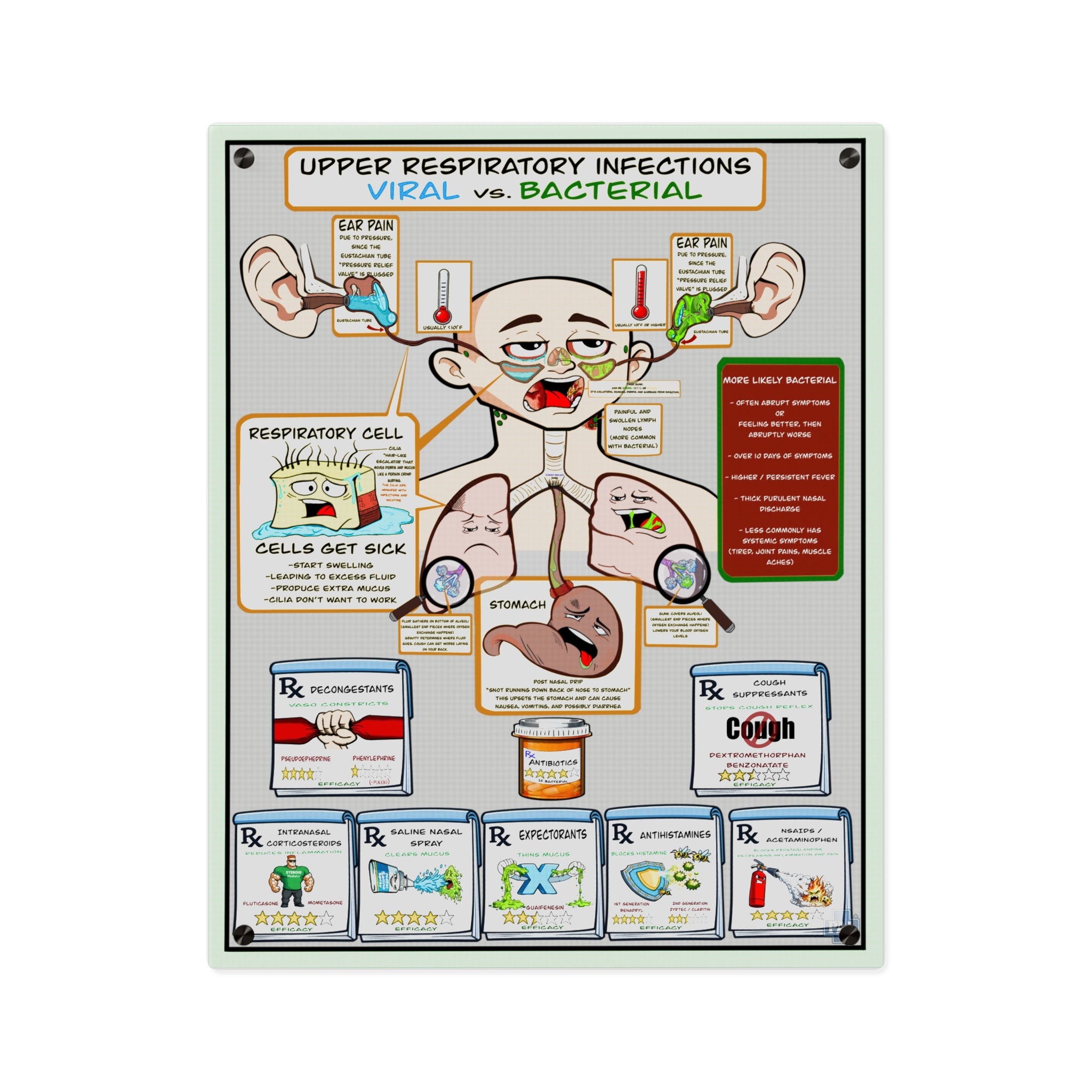 URI Acrylic Wall Art Panel for Patient Education in Clinics and Hospitals