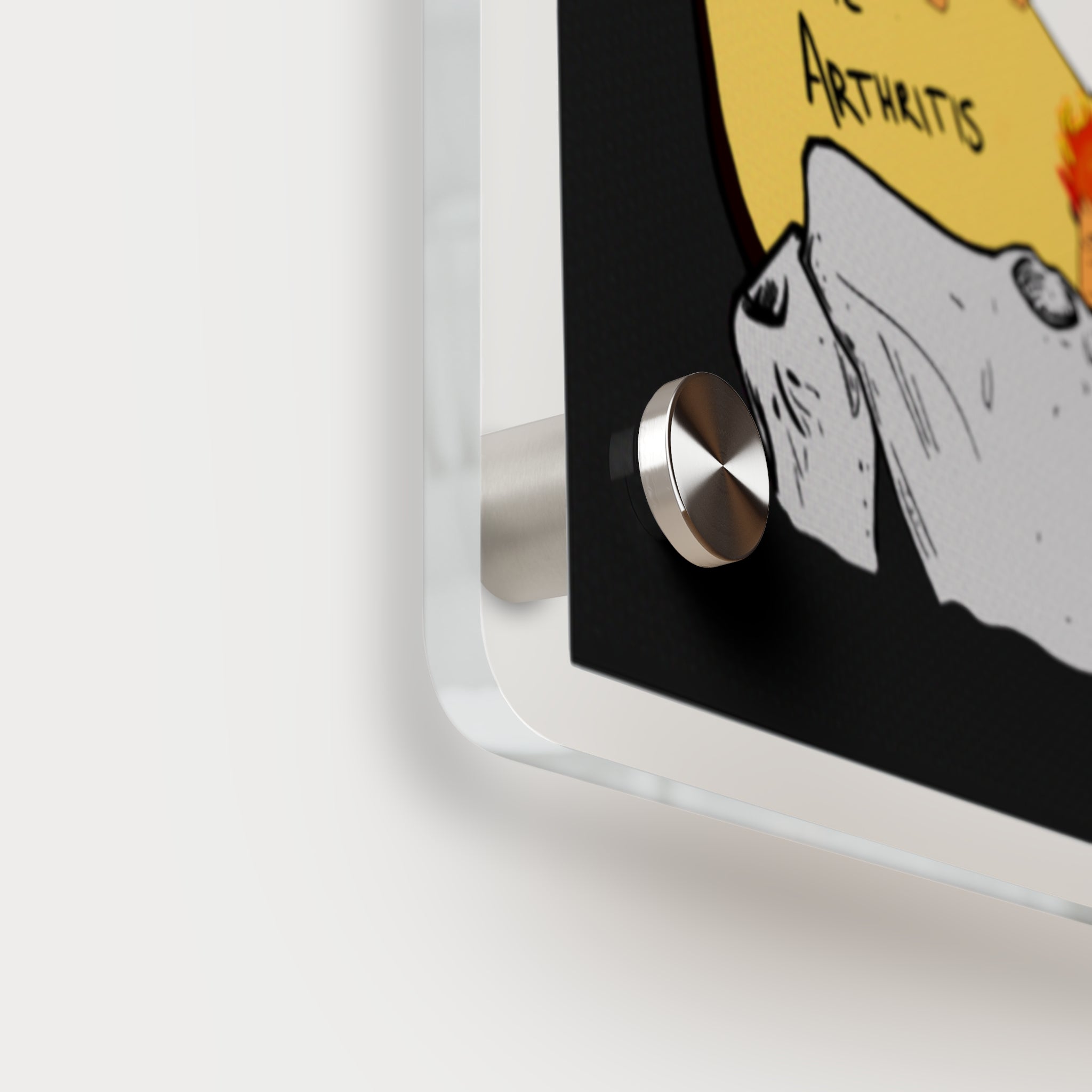 Most Common Bacteria By Location Acrylic Wall Art Panel for Patient Education in Clinics and Hospitals