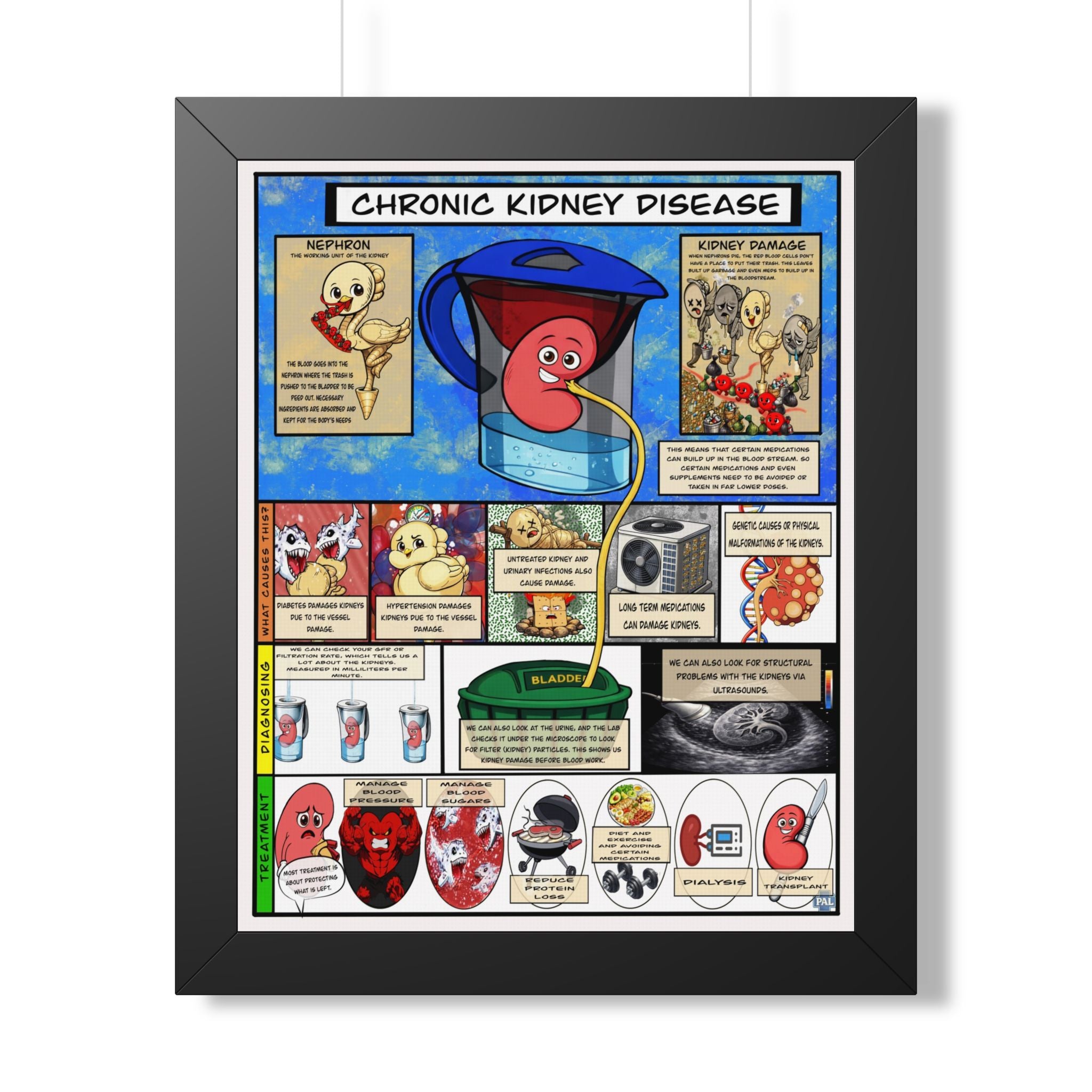 Chronic Kidney Disease Infographic for patient education in clinics, exam rooms, hospitals.